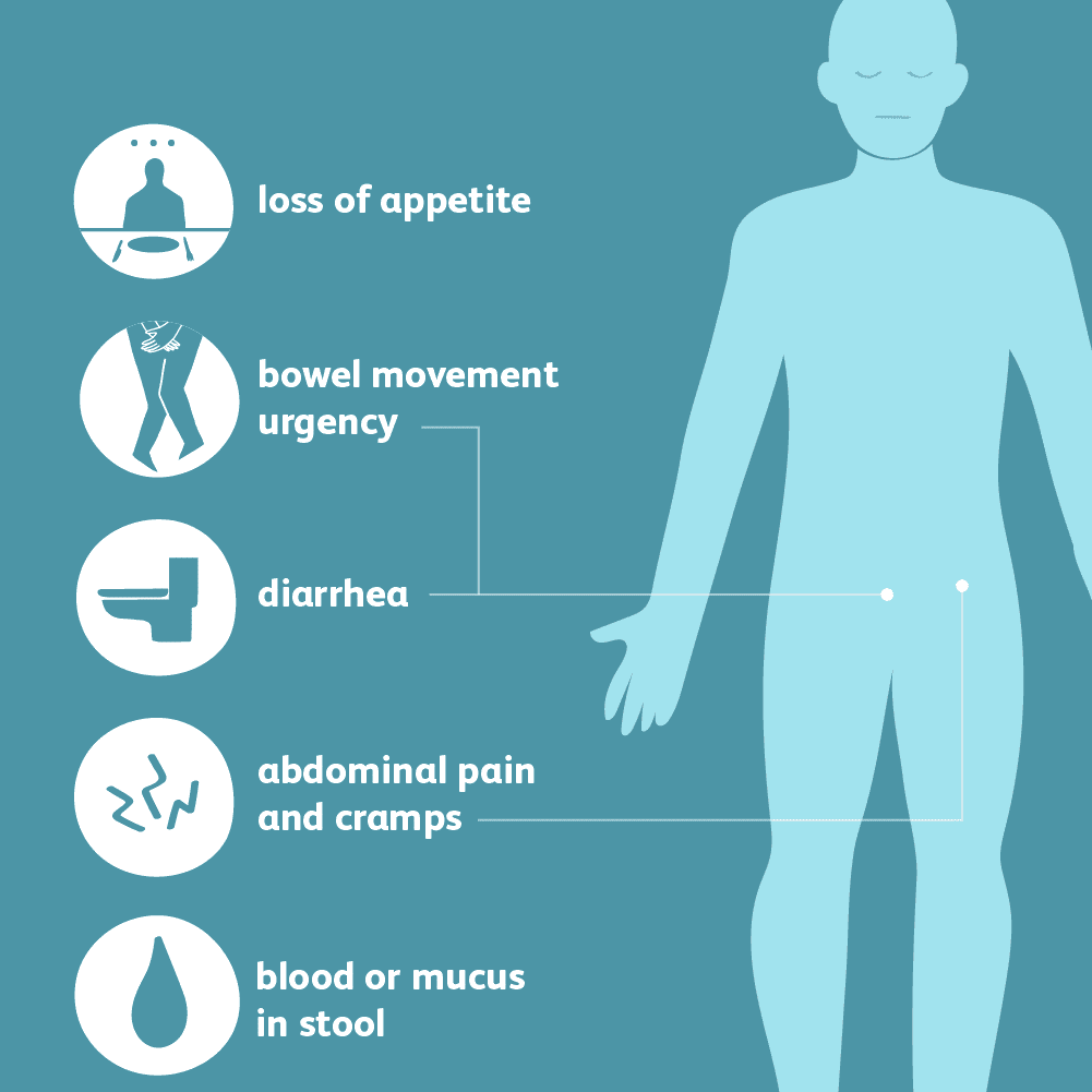 ulcerative_colitis_symptoms-5b4fa6f6c9e77c005bf15bcb