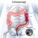 colonoscopy