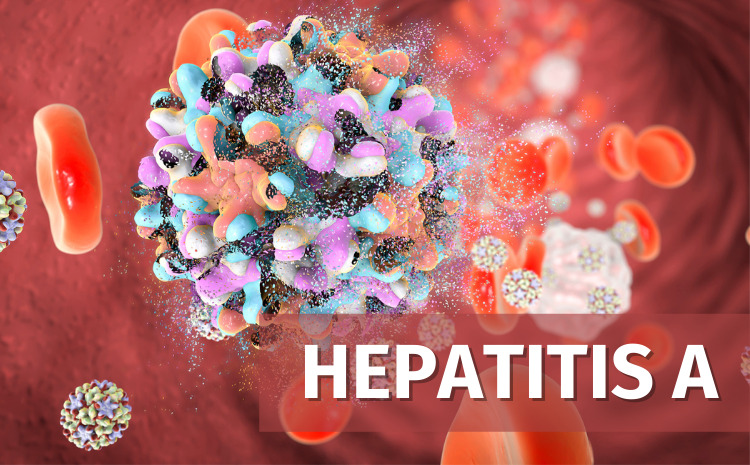 hepatitis A