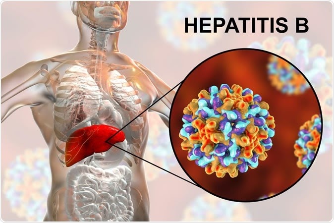 hepatitis B