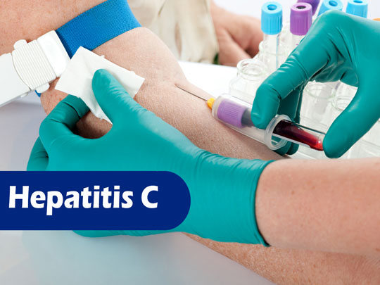 hepatitis C