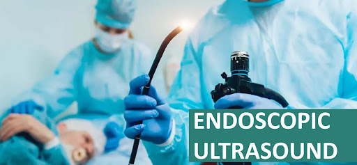 Endoscopic Ultrasound